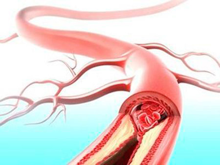 2017.4.11.4502.jpg 2017.4.11.4502.jpg