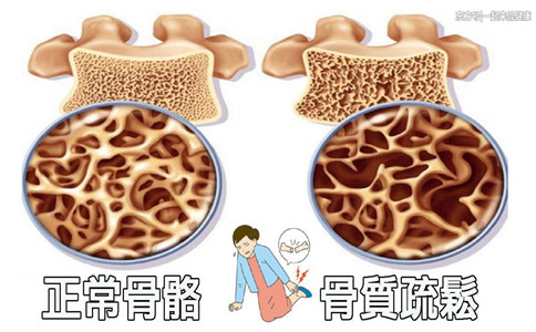 骨密度測定儀廠家.jpg 骨密度測定儀廠家.jpg